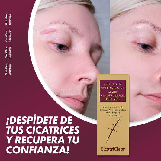¿Te desagrada tu cicatriz? Elimínala
